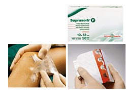 MEDICAZIONE STERILE IN FILM IN POLIURETANO TRASP. SUPRASORB F 10X12CM 10 PEZZI - pharmaluna