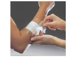 FILM ADESIVO IN POLIURETANO IN ROTOLO TRASPARENTE IMPERMEABILE PER FISSAGGIO DI MEDICAZIONI E CATETERI 5X1000 1MED - pharmaluna